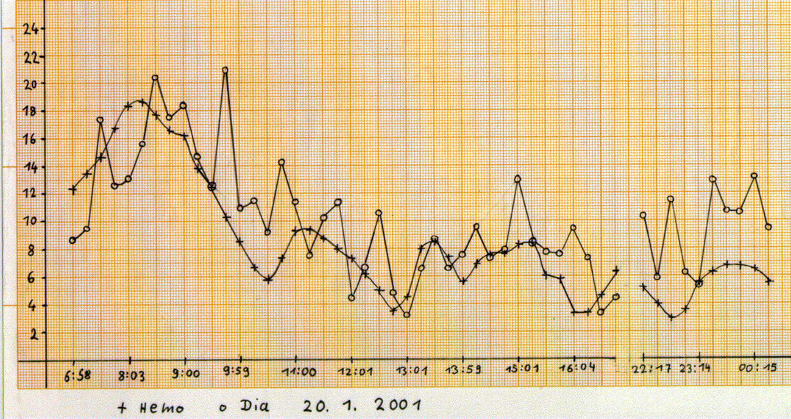 comparison of invasive and noninvasive measurememt of blood glucose